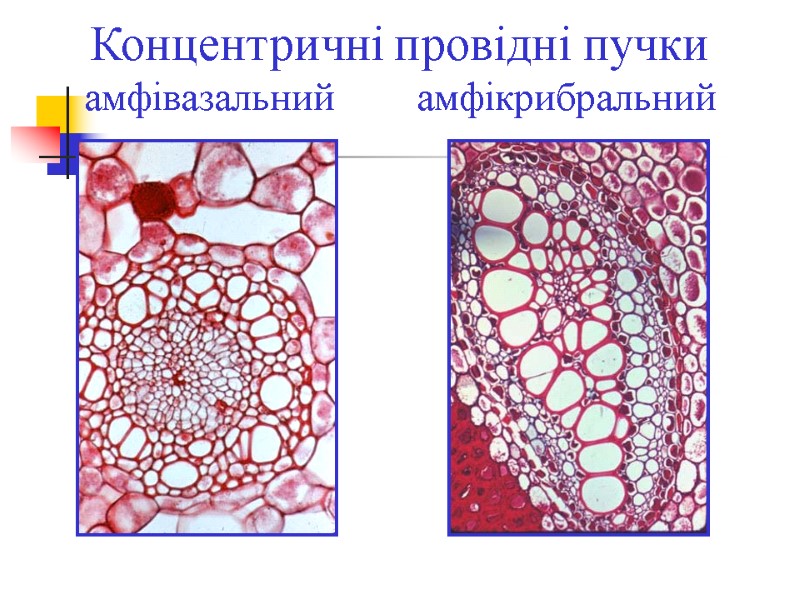Концентричні провідні пучки амфівазальний        амфікрибральний
